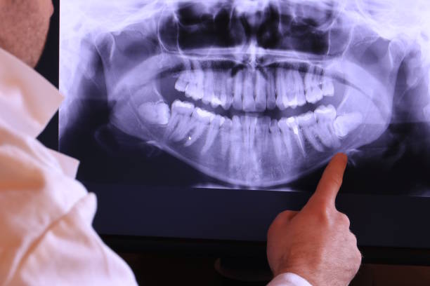 Best Cracked Tooth Emergency Dentist  in Panacea, FL