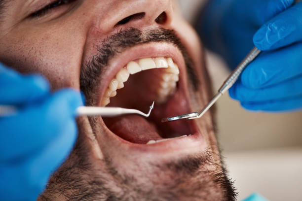 Best Broken Tooth Emergency  in Panacea, FL