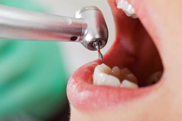 Best Urgent Tooth Repair  in Panacea, FL